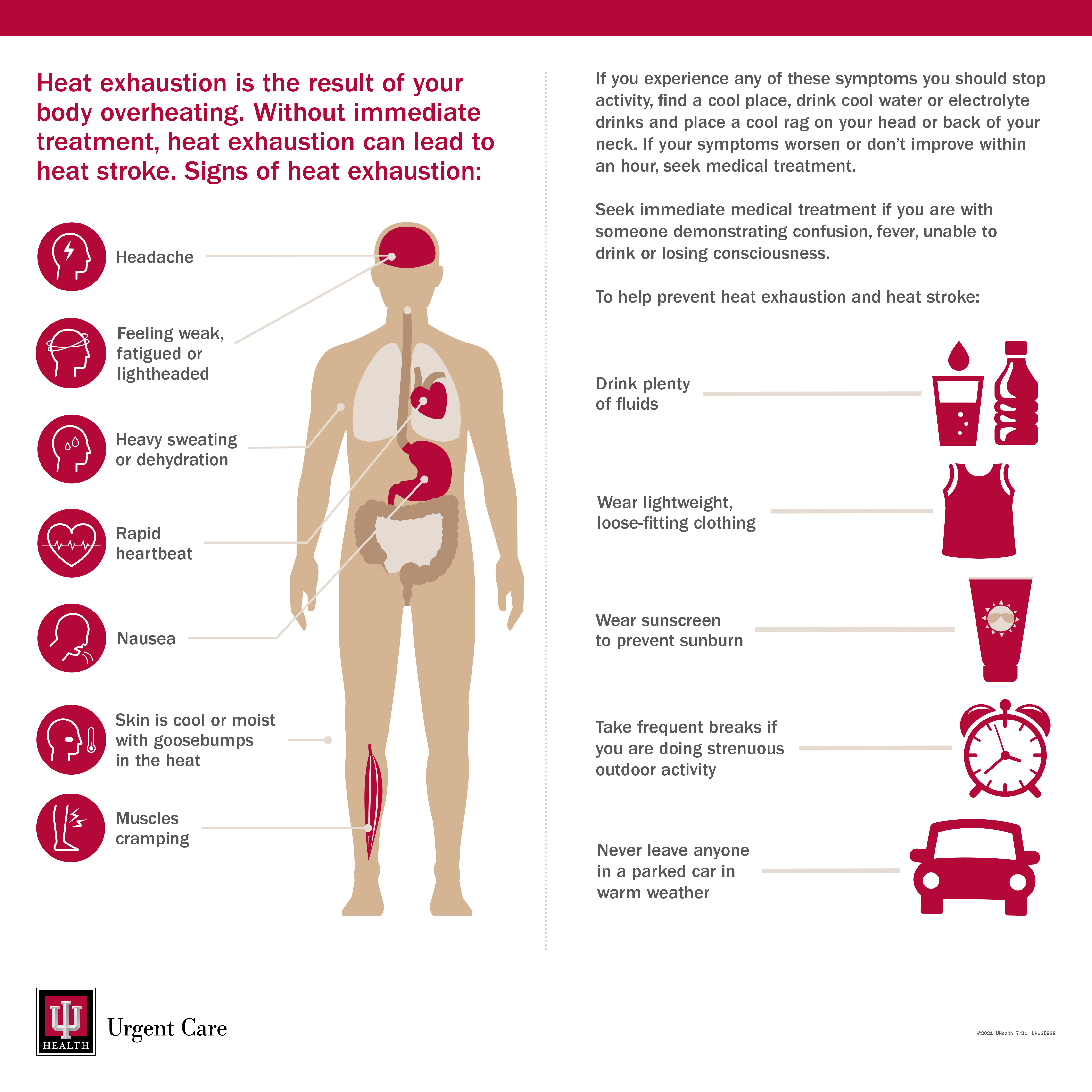 Beat The Heat Protect Yourself Against Heat Exhaustion IU Health Beat The Heat Protect Yourself Against Heat Exhaustion IU Health