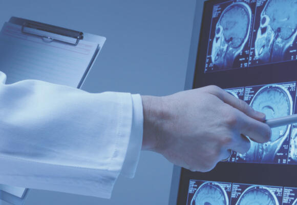 When Minutes Count: Know Risk Factors for Stroke