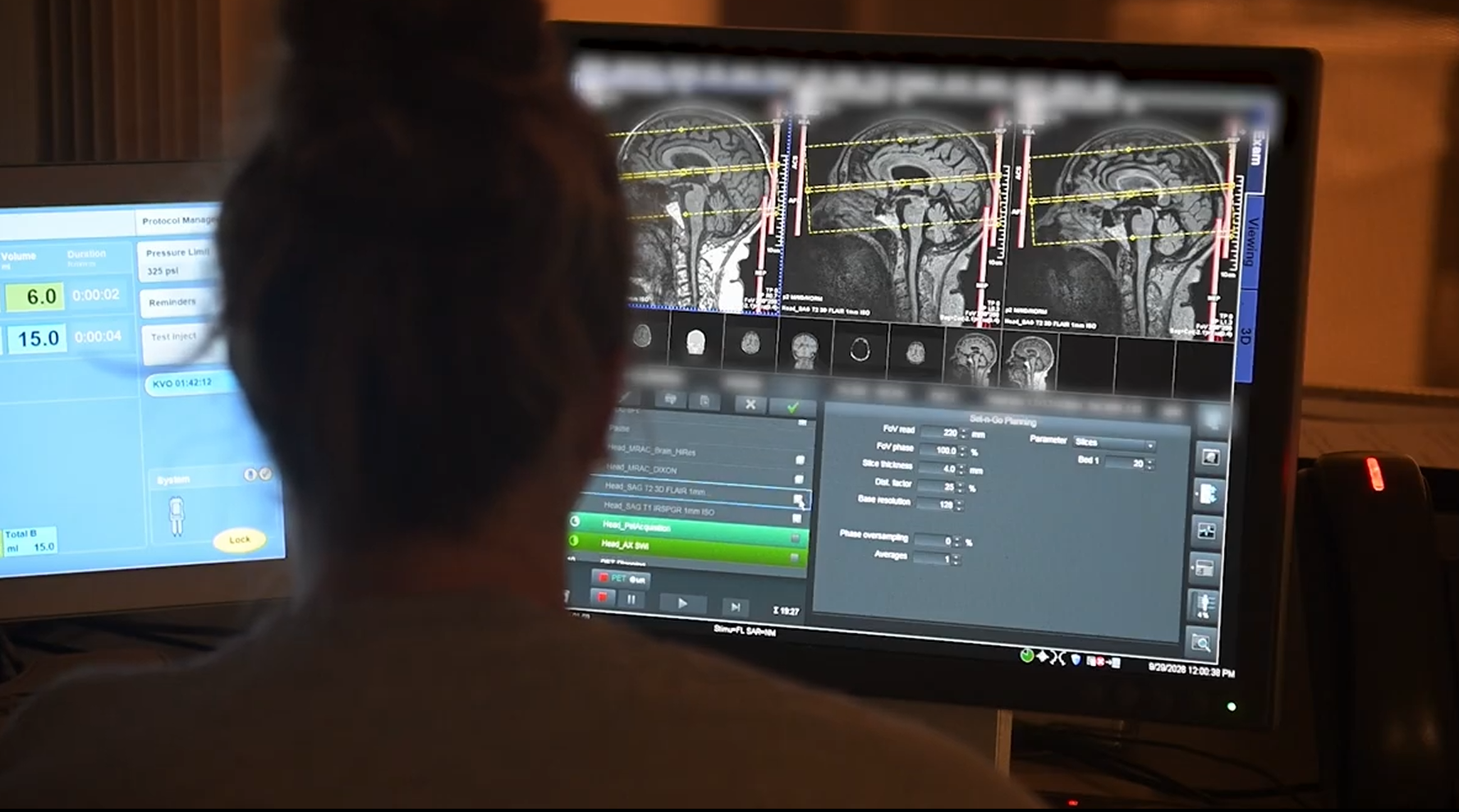 Milestone builds on years of clinical research and IU Health’s investment in theranostics and precision imaging