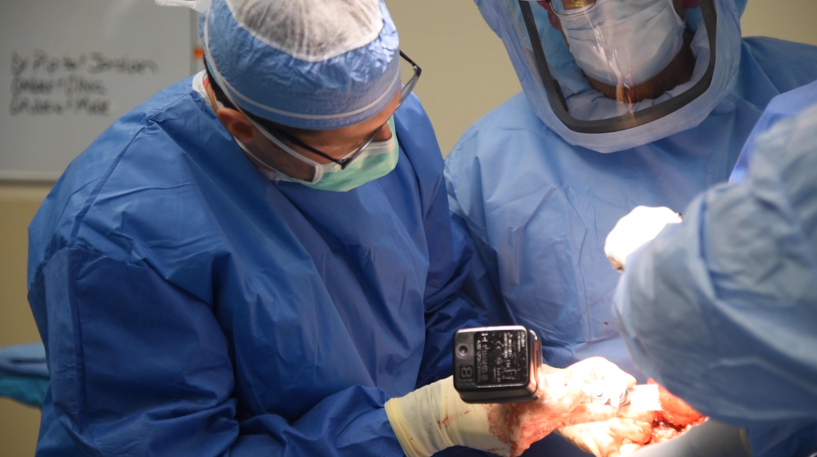 Inside the OR: Reverse total shoulder replacement surgery video