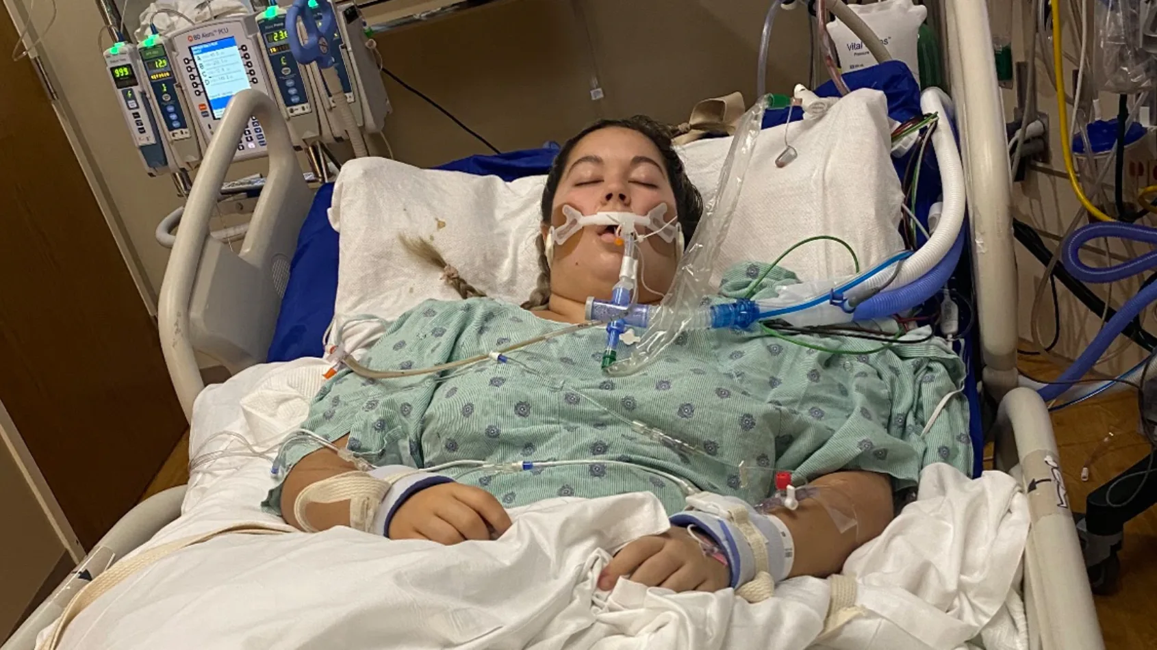 Woman, 23, suffers stroke, four procedures follow in 7 hours