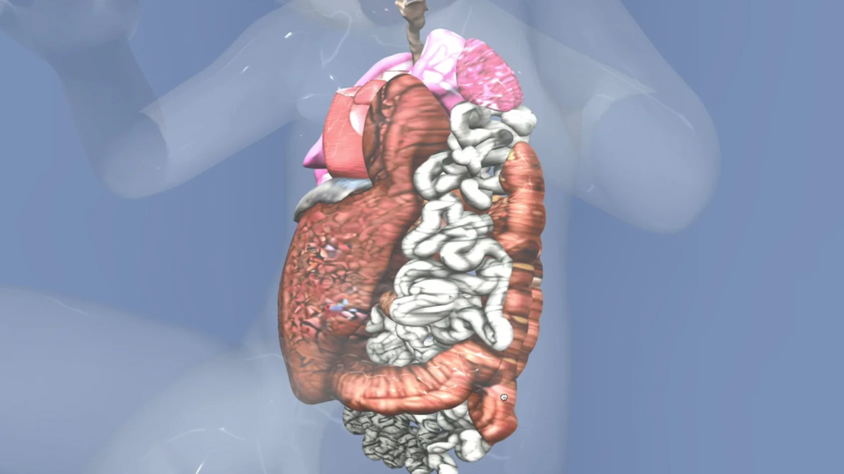 Virtual model helps families better understand difficult diagnosis
