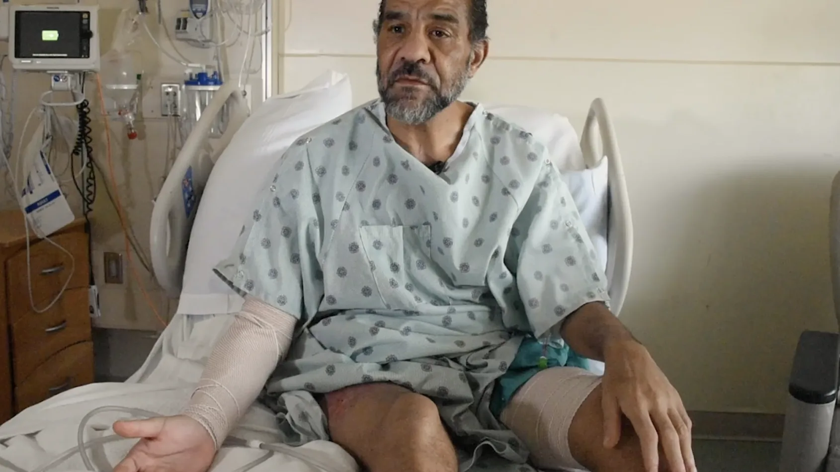 Patient battles for months to fight near-fatal necrotizing soft tissue infection