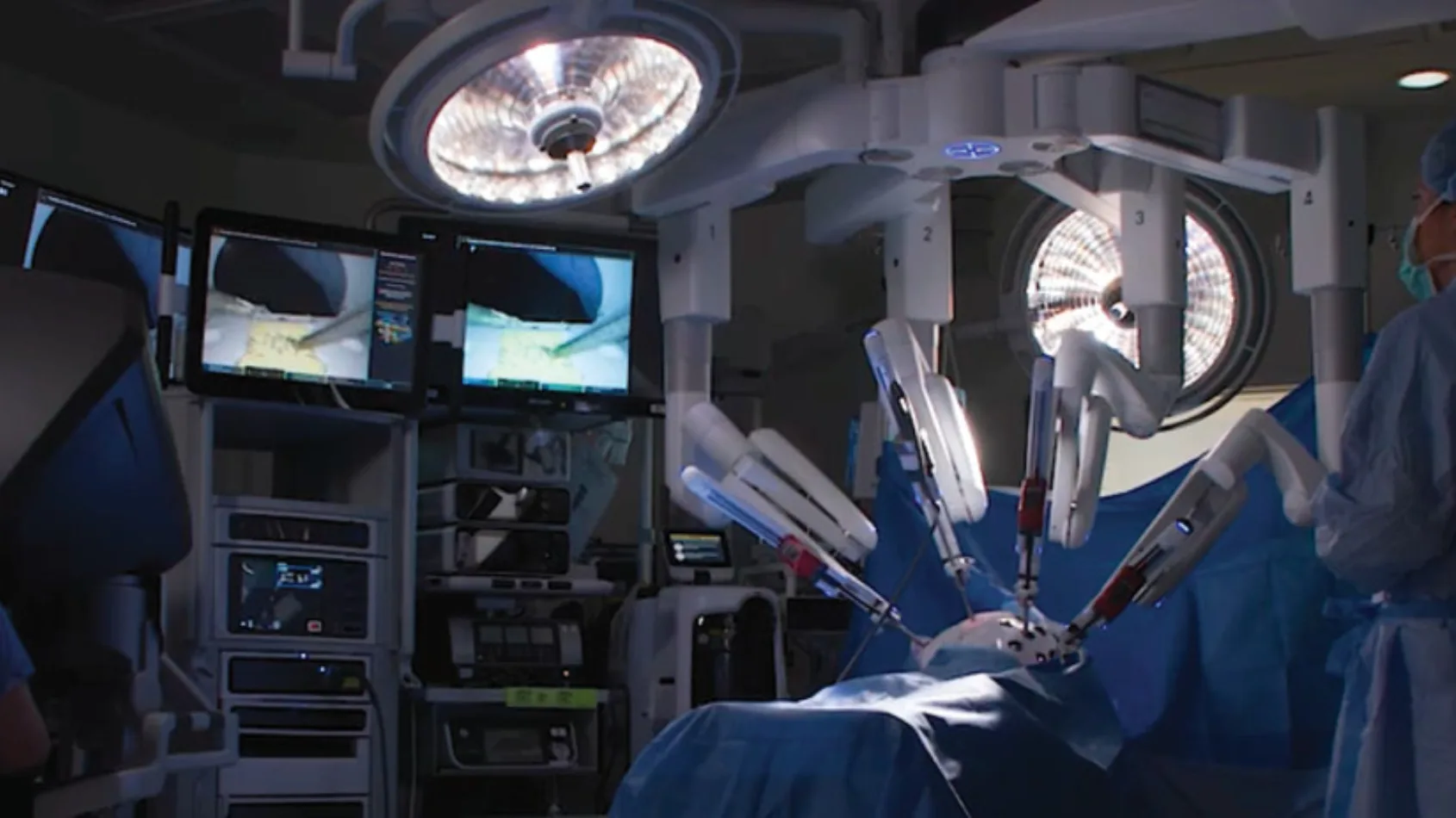 The merits of robotic surgery