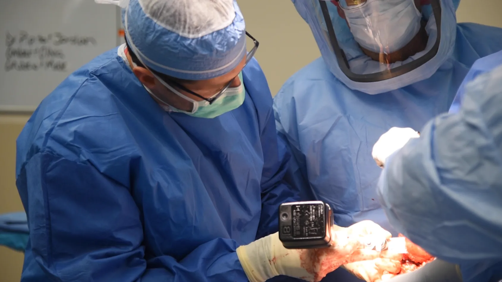 Inside the OR: Reverse total shoulder replacement surgery video