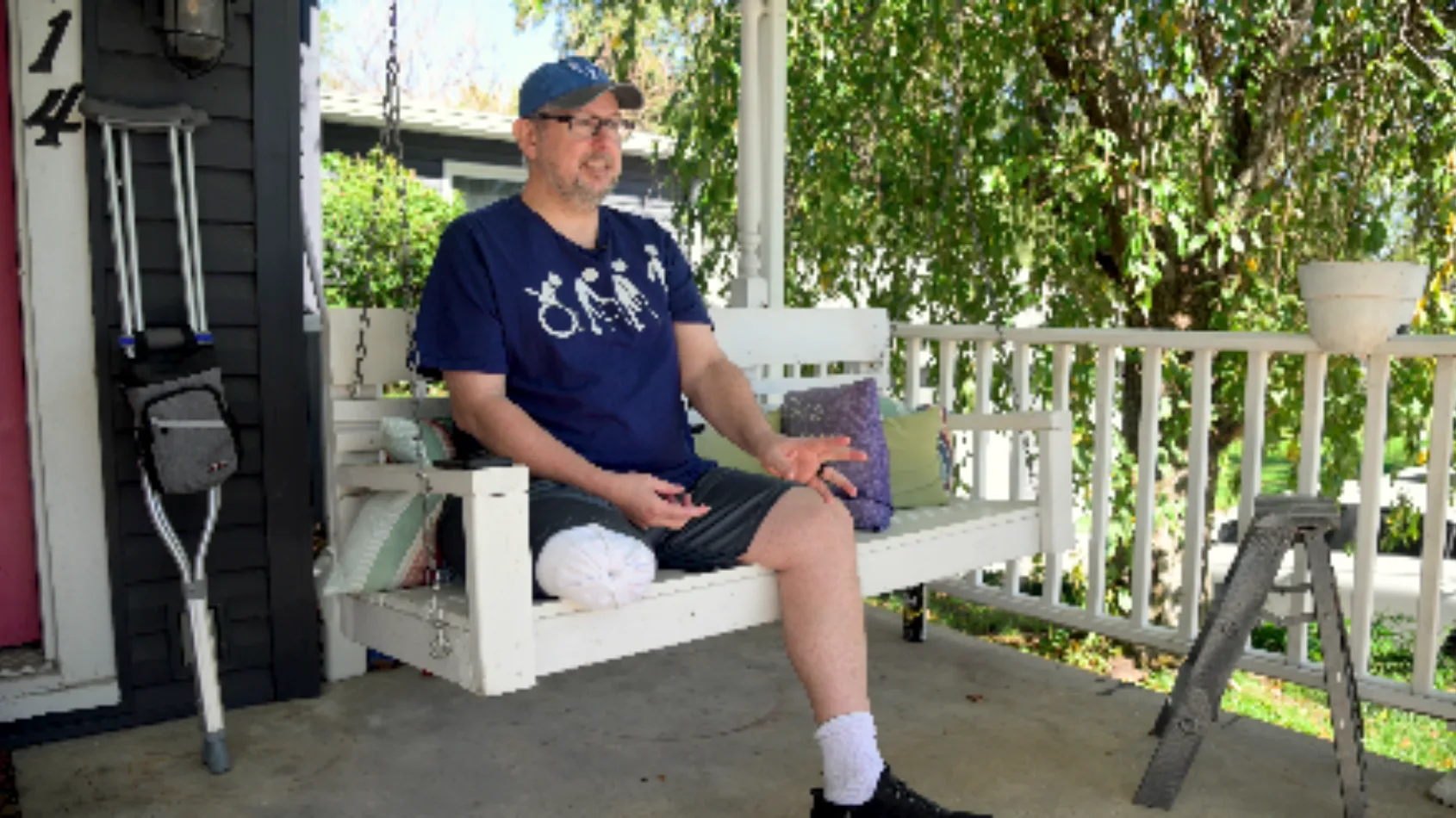 Ball nurse survives motorcycle crash, adjusting to life as amputee