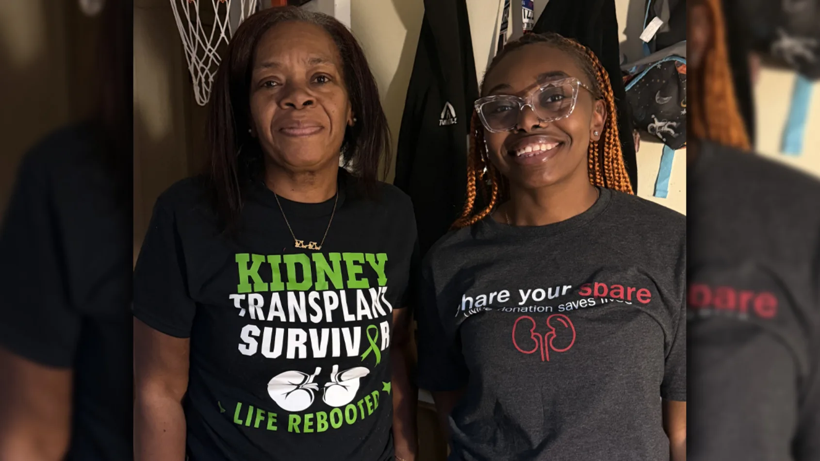 ‘Mama, I’m a match’ – daughter donates kidney to mother