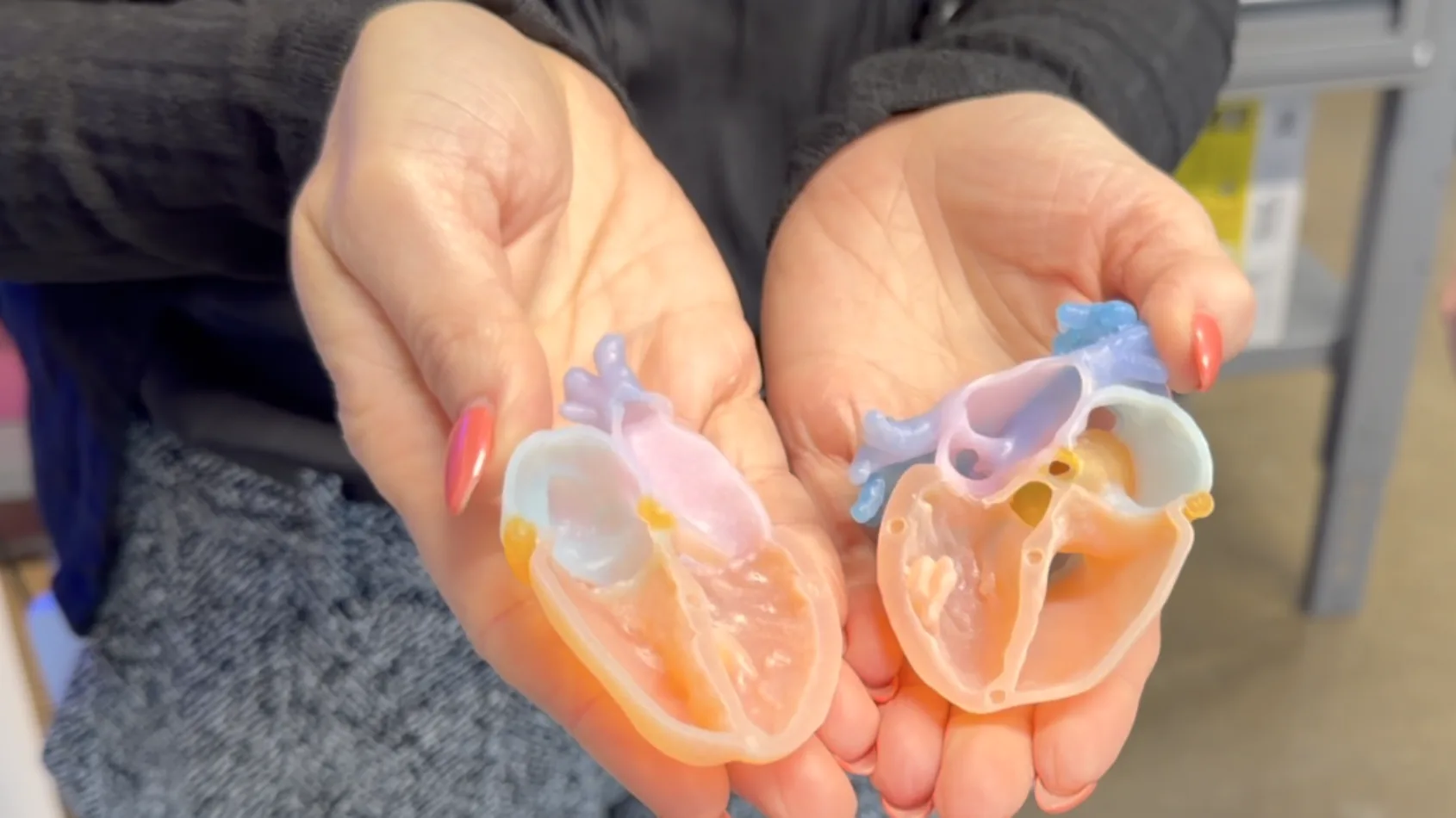 Inside IU Health’s 3D Print Studio: Faster Surgeries, Better Outcomes