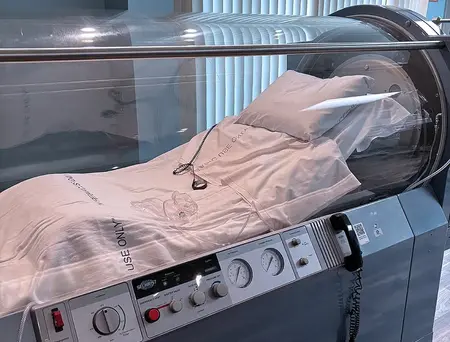 Hyperbaric Oxygen Therapy speeds healing for patient after scalp cancer surgery