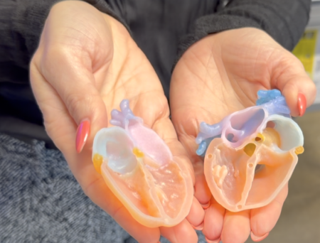 Inside IU Health’s 3D Print Studio: Faster Surgeries, Better Outcomes