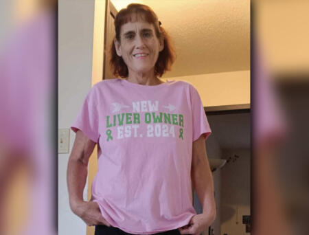 Hours after liver transplant: ‘I had to walk 15 stairs; I have 15 stairs in my apartment’