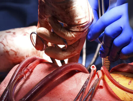 Chest Pain? Acute Heart Attack? Methodist’s The Place You Want To Be