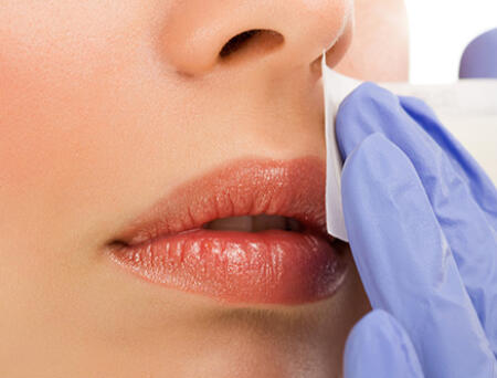 Excess Facial Hair in Women: A Cosmetic Problem or Something More?