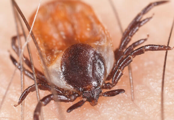 Little bugs pack a big bite: Understanding Lyme disease