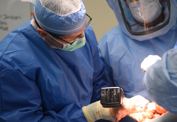Inside the OR: Reverse total shoulder replacement surgery video