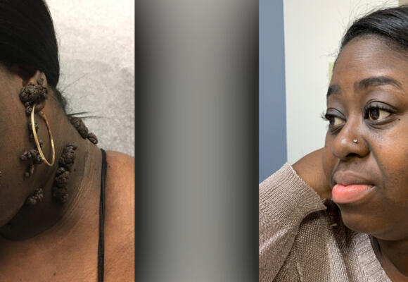 How Dermatologist Helped Restore a Patient’s Self Confidence