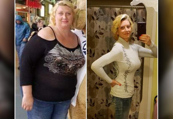 After surgery, she’s half the woman she used to be