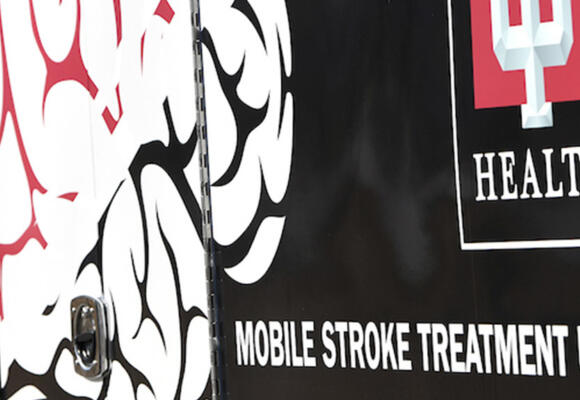 New Mobile Unit Will Race To Patients Having Strokes