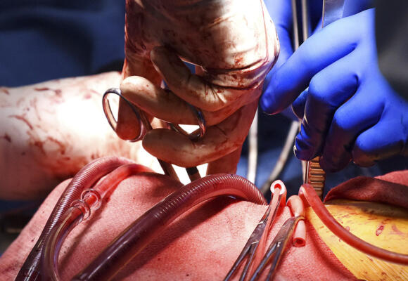 Chest Pain? Acute Heart Attack? Methodist’s The Place You Want To Be