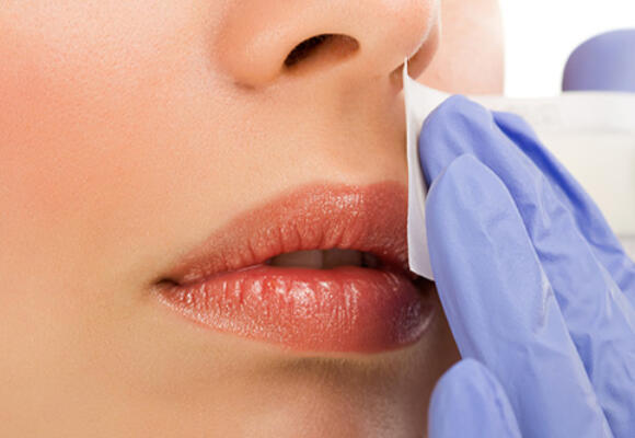 Excess Facial Hair in Women: A Cosmetic Problem or Something More?