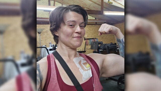 ‘No one talks about bathroom habits:’ Mom, 31, diagnosed with colorectal cancer image.