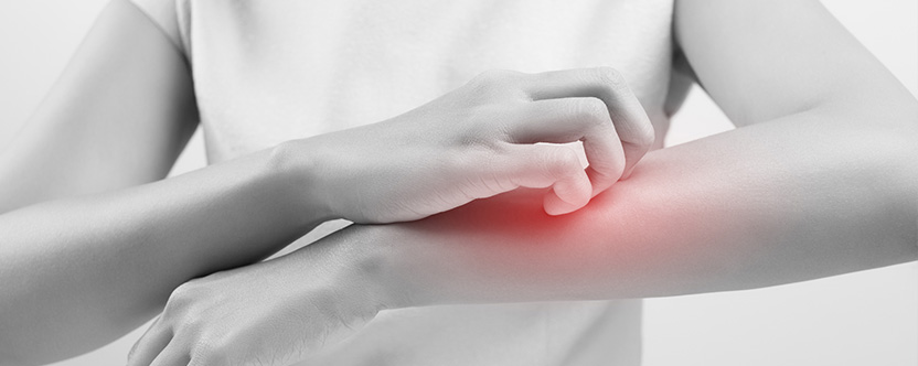 Psoriasis: Why it Gets Worse in Winter and Fall